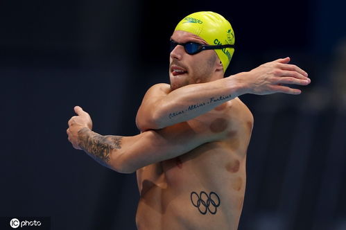 中国游泳队身上的火罐印，传统与竞技的交融见证