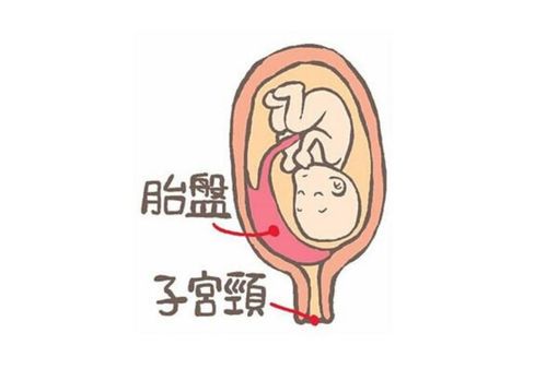 腹膜炎，当肚子哭泣时，我们该注意什么？