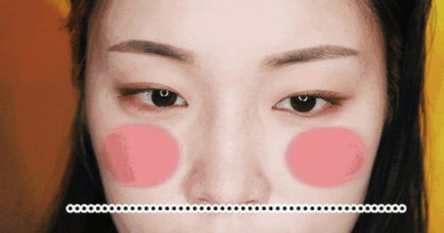 揭秘鼻子里的小秘密，疼痛、结痂与出血的真相