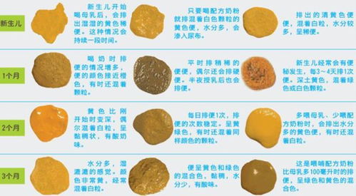 探究黑色粪便背后的秘密，健康信号与生活建议