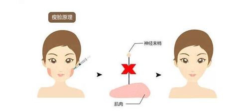 膀胱炎的治疗，让小问题不再困扰你