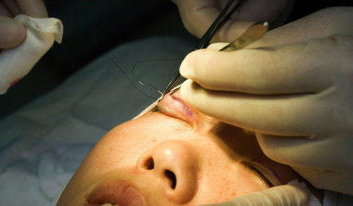 探索脱毛美容院，美丽背后的科学与艺术