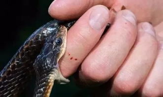 致命的银环，了解银环蛇咬伤的严重性与应对策略