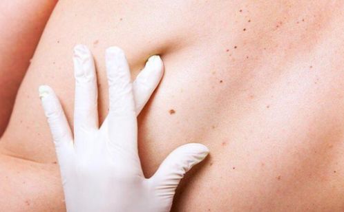 揭秘脖子上的疙瘩，原因、诊断与治疗全攻略