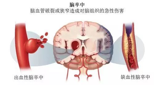 弓形虫病毒，隐藏在日常生活背后的隐形杀手