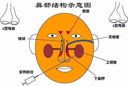 喉咙异物感，原因、诊断与应对策略