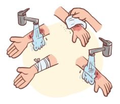 深二度烧伤，了解、预防与治疗